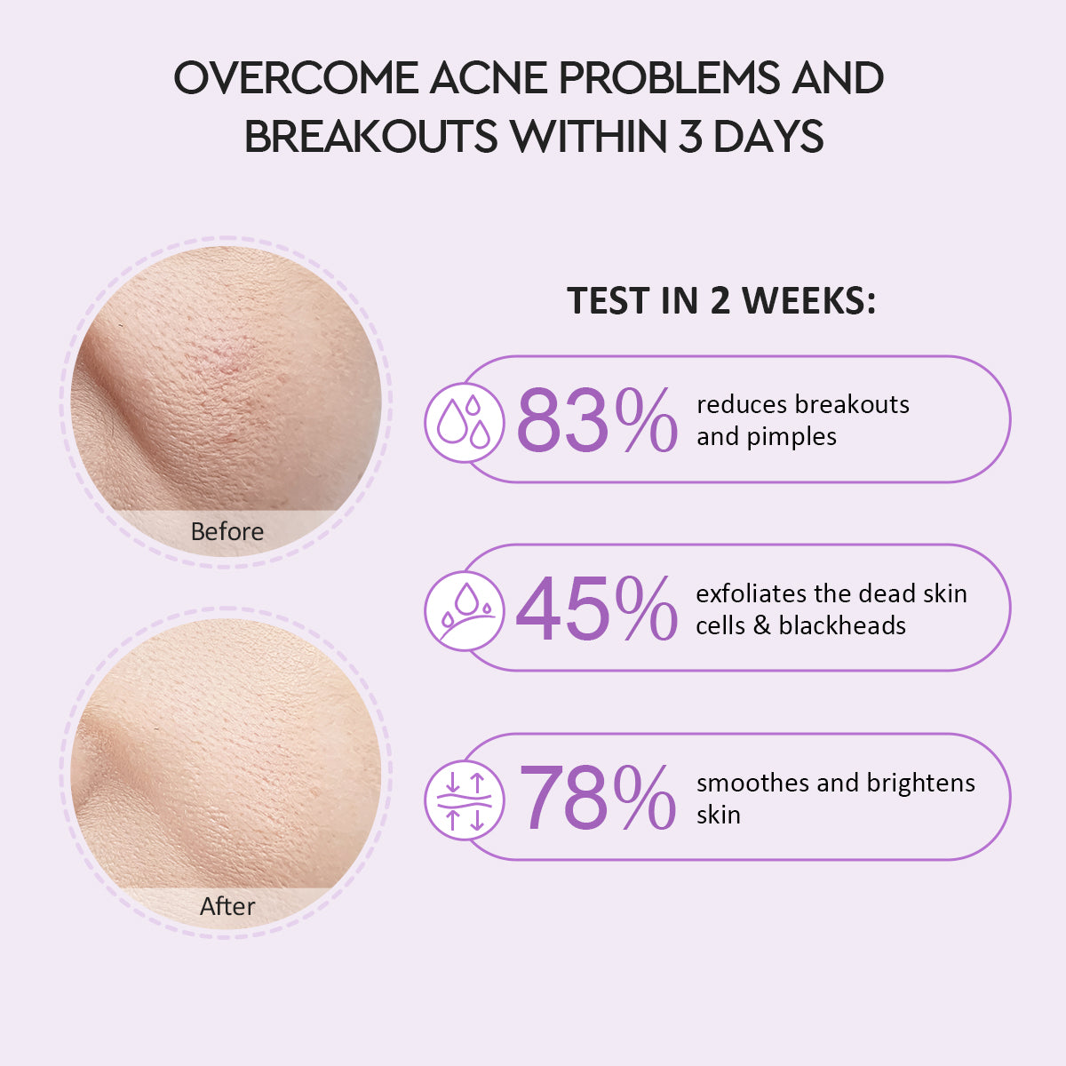 Glad2Glow Blackberry AHA BHA PHA Daily Exfoliating Toner