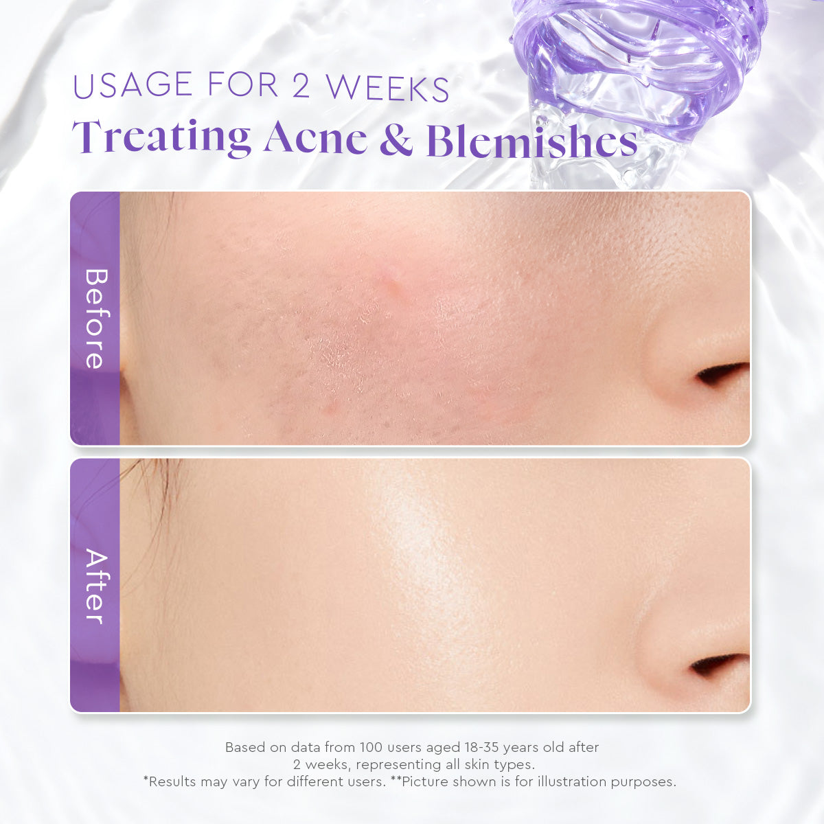 Glad2Glow Blackberry AHA BHA PHA Daily Exfoliating Toner