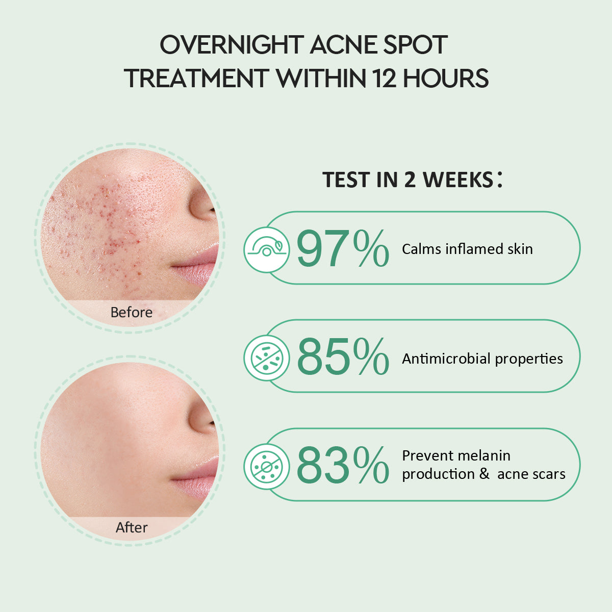 Glad2Glow Centella 2% Salicylic Acid Overnight Acne Spot Treatment