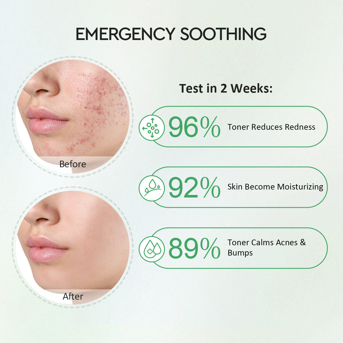 Glad2Glow Centella 2% Ceramide Soothing Toner 40 mL