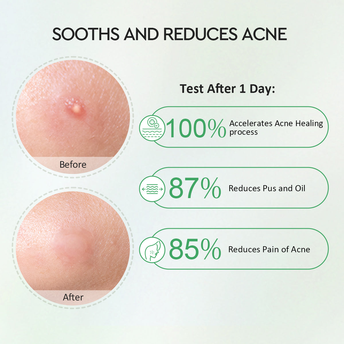 Glad2Glow Centella Salicylic Acid Day Acne Patch