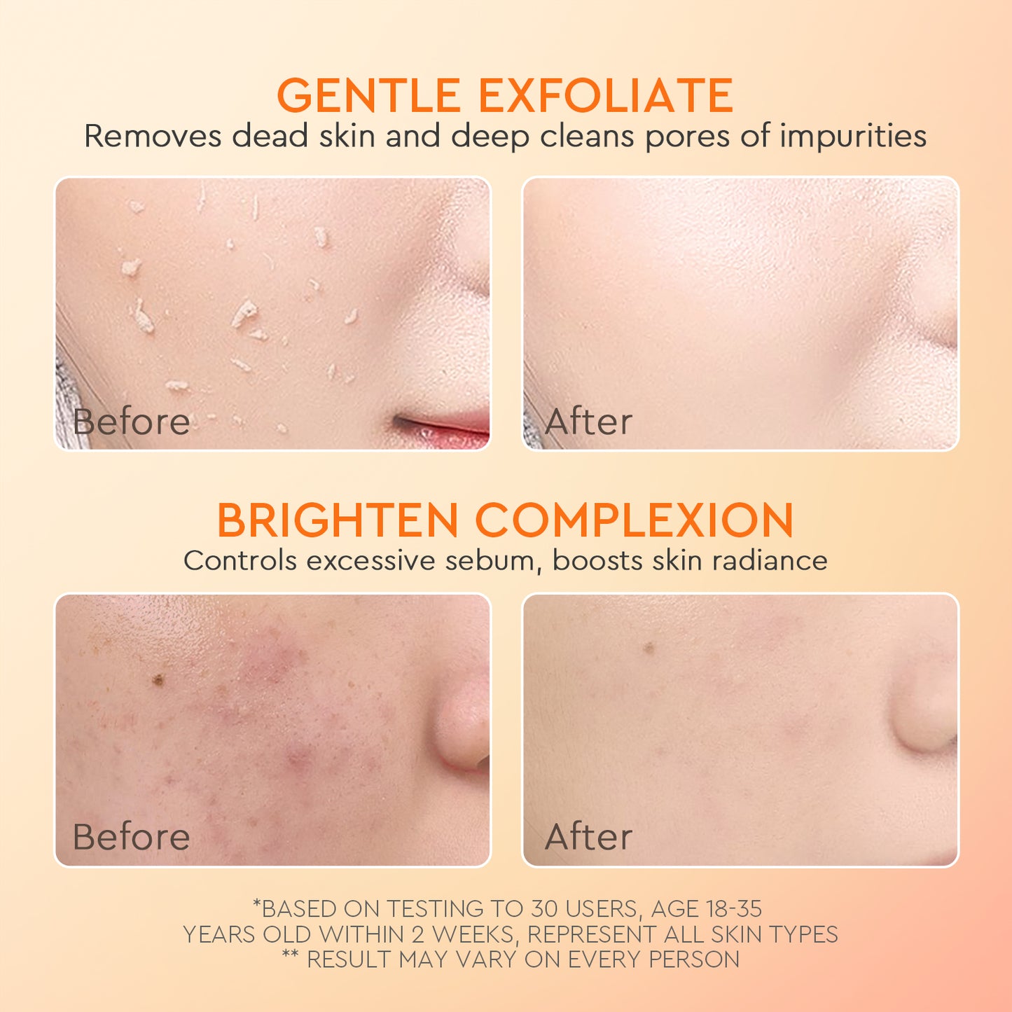 Glad2glow Apricot Glycolic Acid Exfo Smooth Peeling Gel