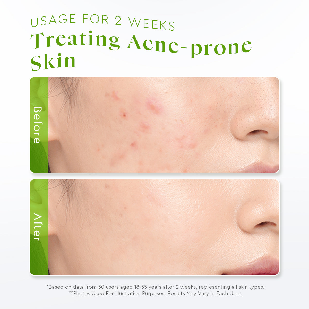 Centella Allantoin Soothing Gel Moisturizer