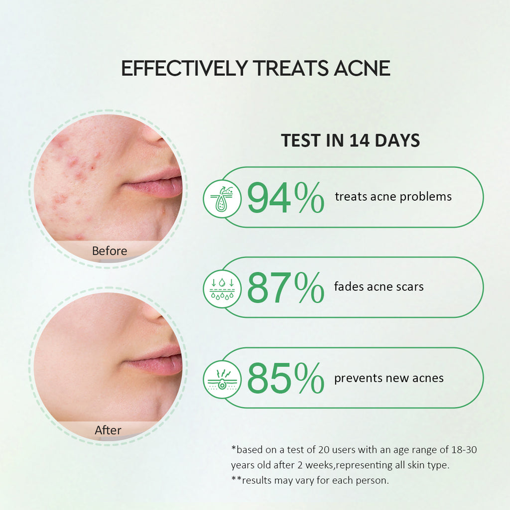 Glad2Glow Centella 2% Salicylic Acid Power Acne Serum