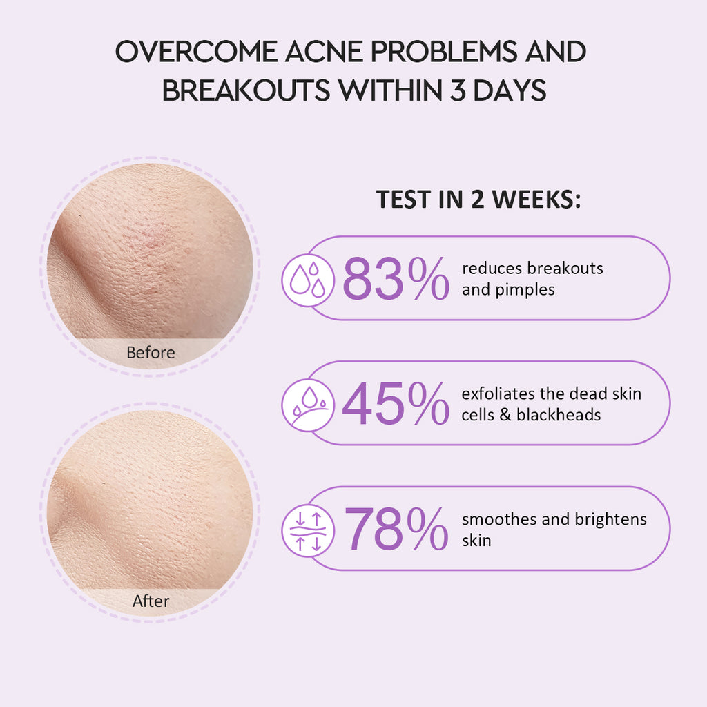 Glad2Glow Blackberry AHA BHA PHA Daily Exfoliating Toner