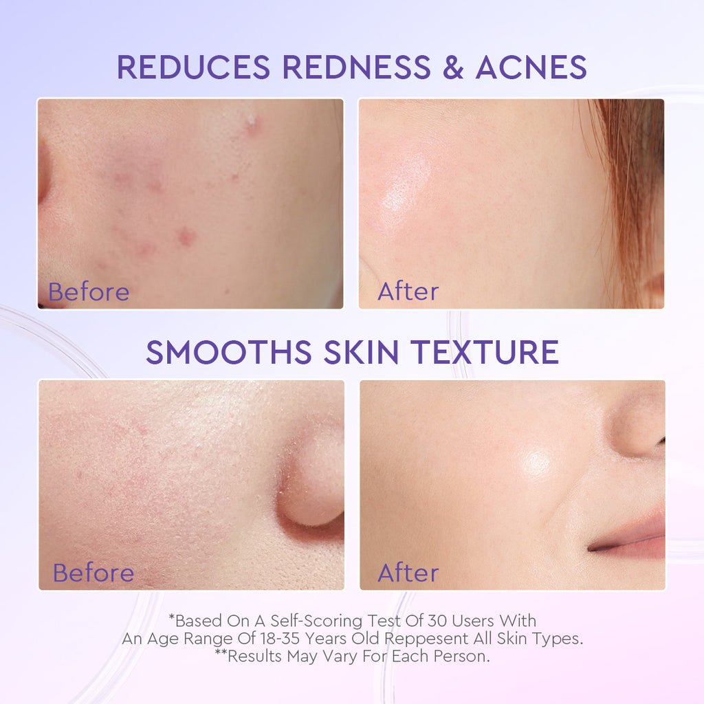 Glad2Glow Blueberry 5% Ceramide Moisturizer