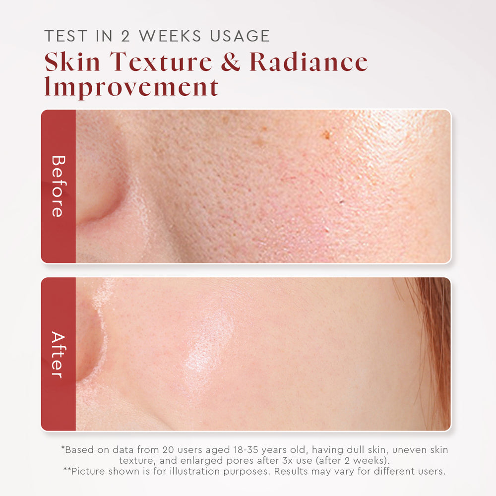 AHA BHA PHA Intensive Peeling Solution