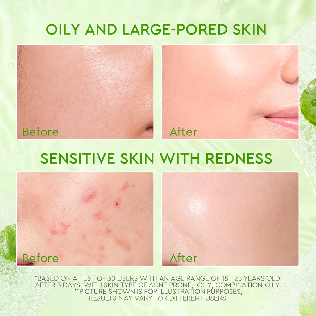 Glad2glow Centella Salicylic Acid Acne Gel Cleanser