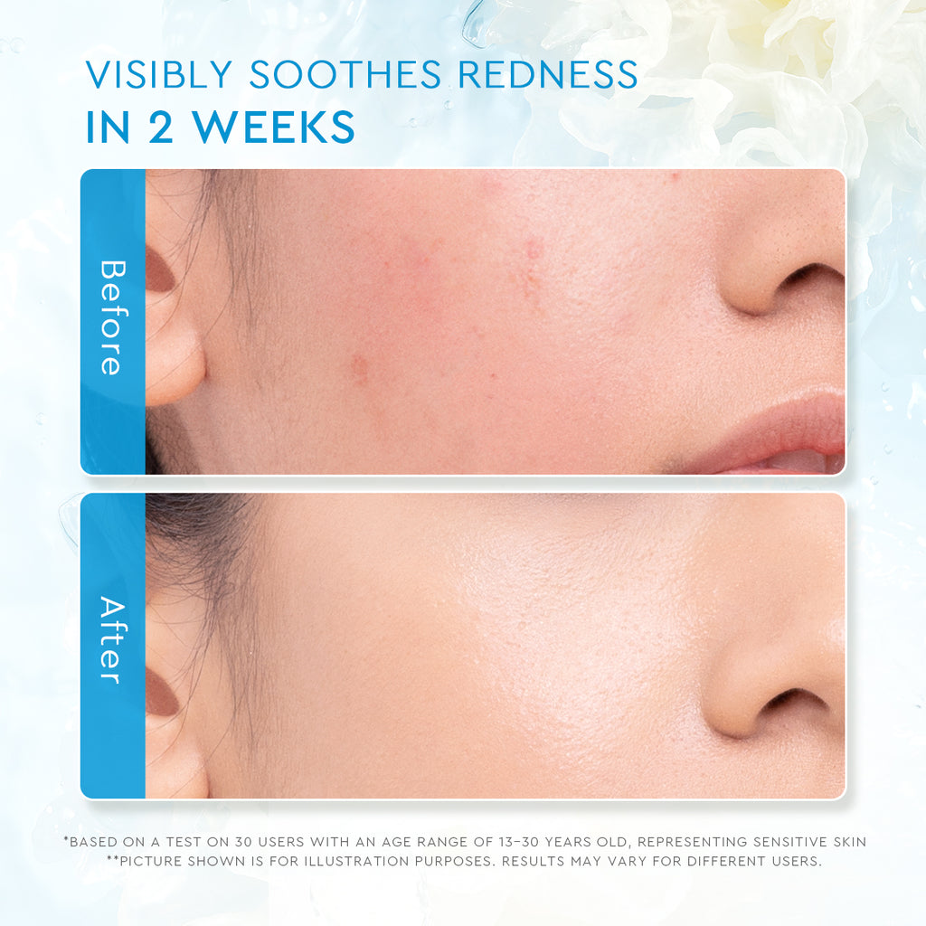 Glad2glow Tremella Vita B5 Sensitive Calming Moisturizer