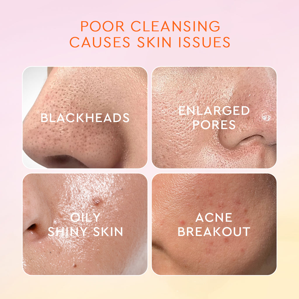 Glad2Glow YUZU AHA Blackhead Exfoliating Cleanser