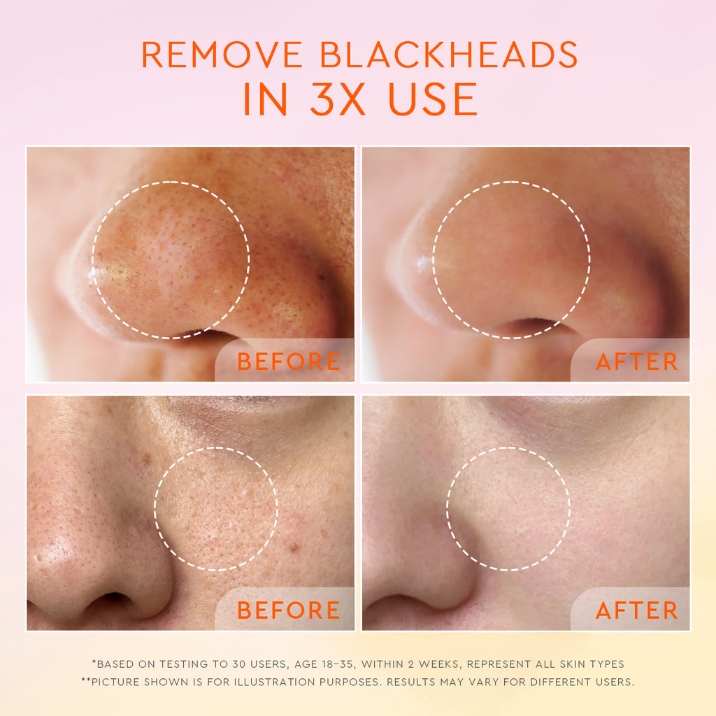Glad2Glow YUZU AHA Blackhead Exfoliating Cleanser