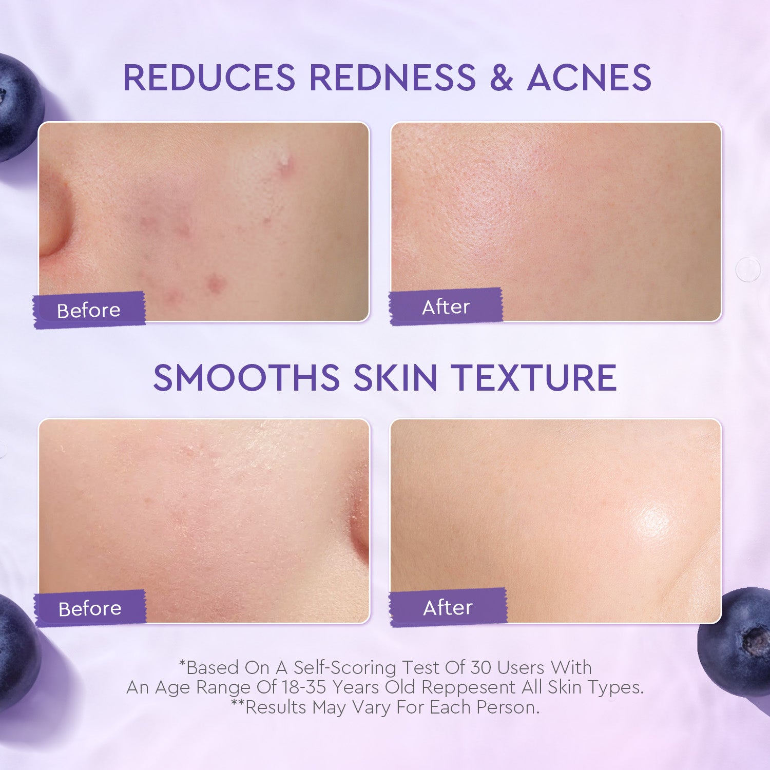 Blueberry ceramide barrier moisturizer