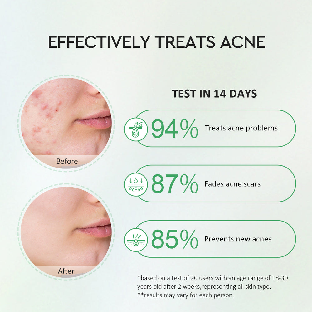 Centella 2% Salicylic Acid Power Clear Acne Serum